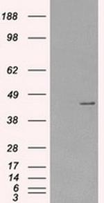 PRKAR1A Antibody in Western Blot (WB)