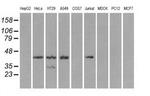 PRKAR1A Antibody in Western Blot (WB)