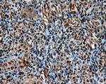 LTA4H Antibody in Immunohistochemistry (Paraffin) (IHC (P))