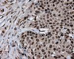 LTA4H Antibody in Immunohistochemistry (Paraffin) (IHC (P))