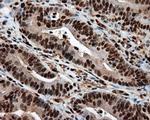 LTA4H Antibody in Immunohistochemistry (Paraffin) (IHC (P))