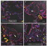 LTA4H Antibody in Immunohistochemistry (IHC)