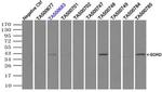 Sorbitol Dehydrogenase Antibody in Western Blot (WB)