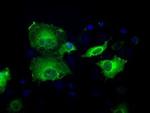 Sorbitol Dehydrogenase Antibody in Immunocytochemistry (ICC/IF)