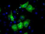 Sorbitol Dehydrogenase Antibody in Immunocytochemistry (ICC/IF)