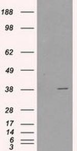 Sorbitol Dehydrogenase Antibody in Western Blot (WB)