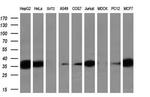 Sorbitol Dehydrogenase Antibody in Western Blot (WB)