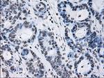 ID3 Antibody in Immunohistochemistry (Paraffin) (IHC (P))