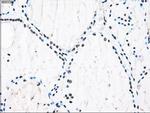 ID3 Antibody in Immunohistochemistry (Paraffin) (IHC (P))