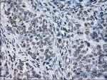 ID3 Antibody in Immunohistochemistry (Paraffin) (IHC (P))