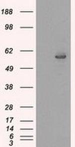 CYP2E1 Antibody in Western Blot (WB)