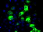 CYP2E1 Antibody in Immunocytochemistry (ICC/IF)