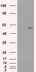 CYP2E1 Antibody in Western Blot (WB)