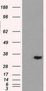 AKR1A1 Antibody in Western Blot (WB)