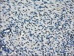 AKR1A1 Antibody in Immunohistochemistry (Paraffin) (IHC (P))