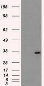 AKR1A1 Antibody in Western Blot (WB)