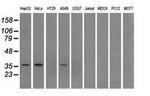 AKR1A1 Antibody in Western Blot (WB)