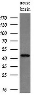 PPME1 Antibody in Western Blot (WB)