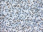 TTLL12 Antibody in Immunohistochemistry (Paraffin) (IHC (P))