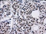 TTLL12 Antibody in Immunohistochemistry (Paraffin) (IHC (P))