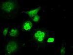 MAN1 Antibody in Immunocytochemistry (ICC/IF)