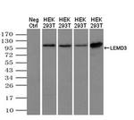 MAN1 Antibody in Western Blot (WB)