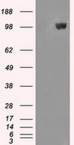 MAN1 Antibody in Western Blot (WB)