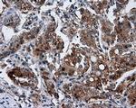 GBE1 Antibody in Immunohistochemistry (Paraffin) (IHC (P))