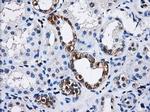 PPME1 Antibody in Immunohistochemistry (Paraffin) (IHC (P))