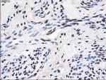 GBE1 Antibody in Immunohistochemistry (Paraffin) (IHC (P))