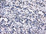 GBE1 Antibody in Immunohistochemistry (Paraffin) (IHC (P))