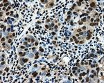 LOX Antibody in Immunohistochemistry (Paraffin) (IHC (P))