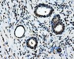 LOX Antibody in Immunohistochemistry (Paraffin) (IHC (P))