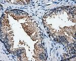 HuR Antibody in Immunohistochemistry (Paraffin) (IHC (P))