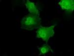 Transketolase Antibody in Immunocytochemistry (ICC/IF)