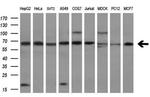 Transketolase Antibody in Western Blot (WB)