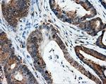 HIPPI Antibody in Immunohistochemistry (Paraffin) (IHC (P))