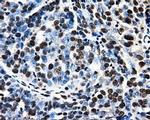 PSMC3 Antibody in Immunohistochemistry (Paraffin) (IHC (P))