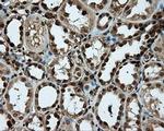 PSMC3 Antibody in Immunohistochemistry (Paraffin) (IHC (P))