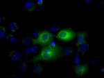 IFIT1 Antibody in Immunocytochemistry (ICC/IF)