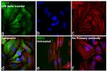 IFIT1 Antibody in Immunocytochemistry (ICC/IF)