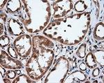 IFIT1 Antibody in Immunohistochemistry (Paraffin) (IHC (P))