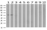 IFIT1 Antibody in Western Blot (WB)