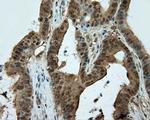 CUGBP1 Antibody in Immunohistochemistry (Paraffin) (IHC (P))