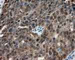 CUGBP1 Antibody in Immunohistochemistry (Paraffin) (IHC (P))