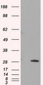 TPMT Antibody in Western Blot (WB)