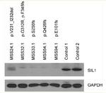 SIL1 Antibody in Western Blot (WB)