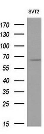 NPR3 Antibody in Western Blot (WB)