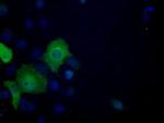 ATP Citrate Lyase Antibody in Immunocytochemistry (ICC/IF)