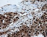 ATP Citrate Lyase Antibody in Immunohistochemistry (Paraffin) (IHC (P))